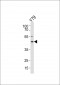 RDH10 Antibody (Center)
